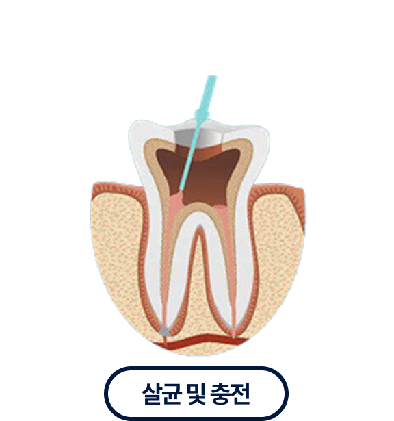살균및충전